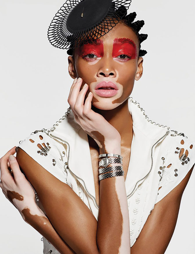 winnie-harlow-stuns-on-the-cover-of-harpers-bazaar-singapore-may-issue